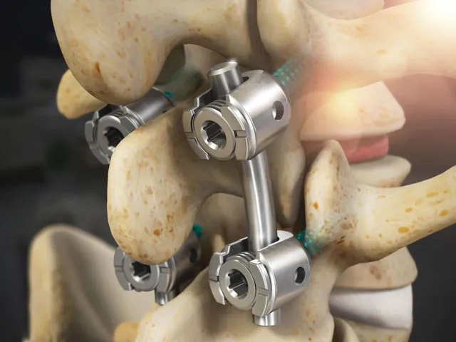 Medical Device | Image Directory